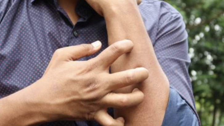 Lexington Park Eczema Dermatologist Appointments